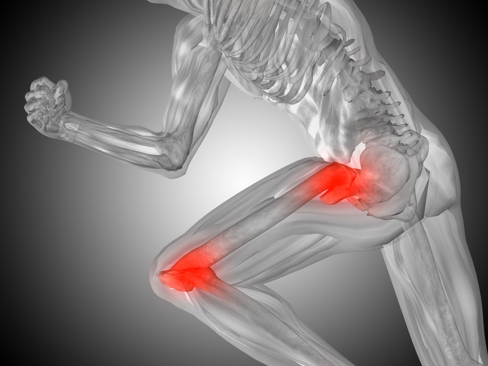 Hip & Knee Pain Dickinson, TX